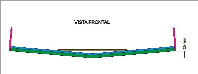 K-Free Frontal.jpg